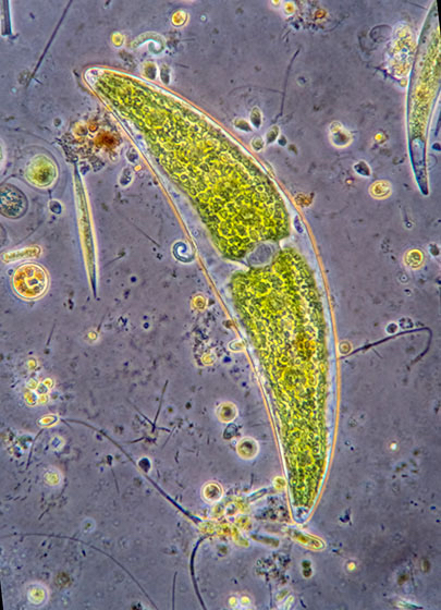 bacteria under microscope