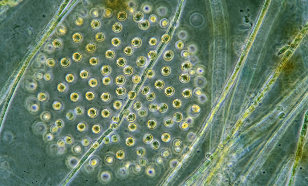 Algae under microscope